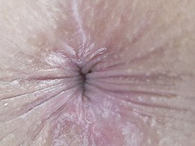 300人の尻穴 第2集 サンプル動画サムネイル